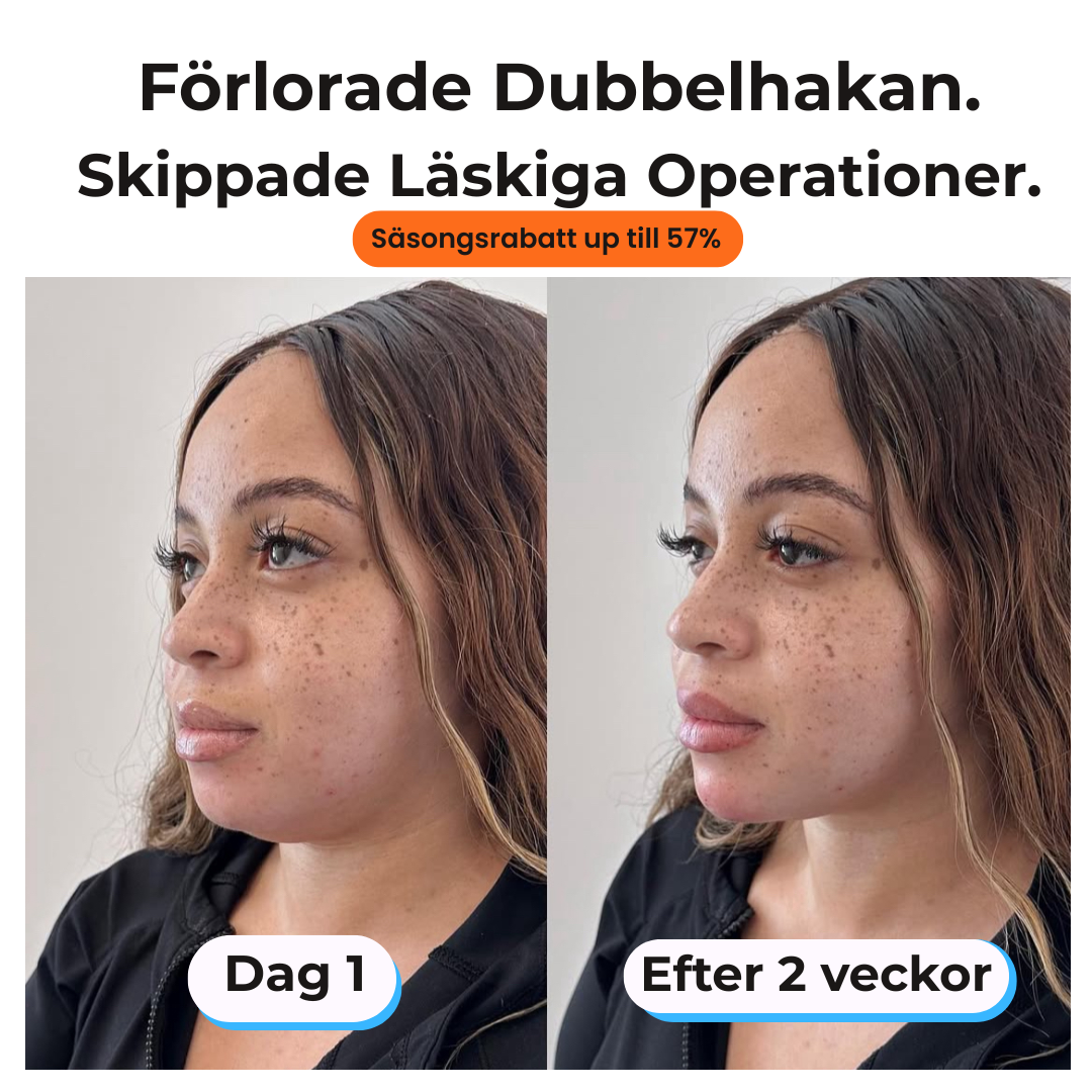 Eelhoe Ansiktslyft: Med Kollagen För Att Framhäva Ditt Käkben